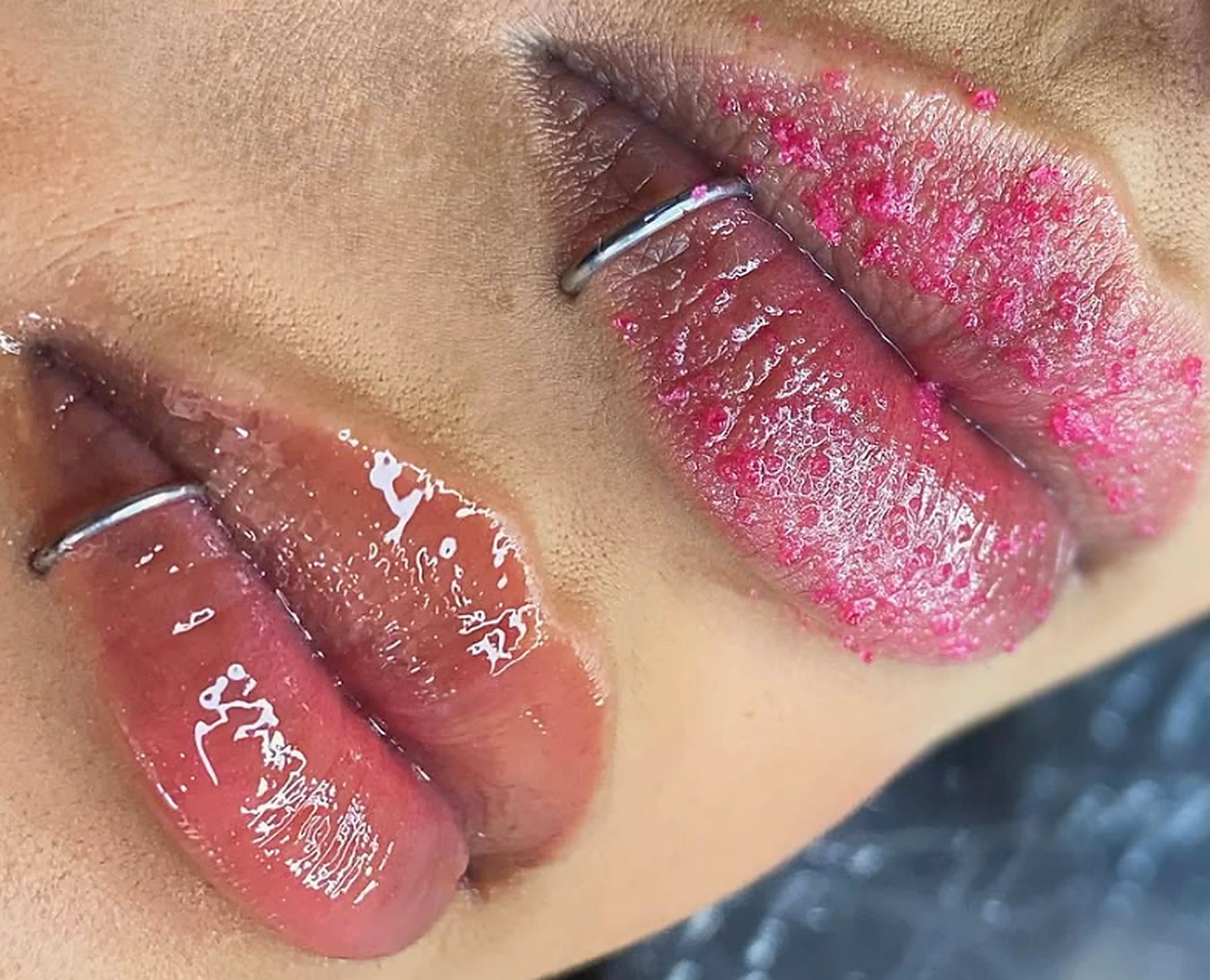Resultado de spa labial com esfoliação e hidratação